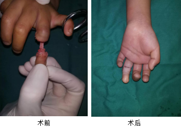 <a href='http://lnzszx.com/' target='_blank'><u>徐州仁慈醫(yī)院</u></a>手外科