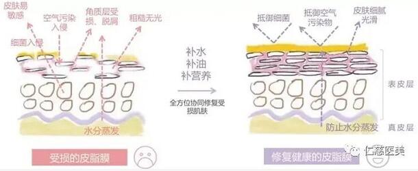 皮脂膜受損