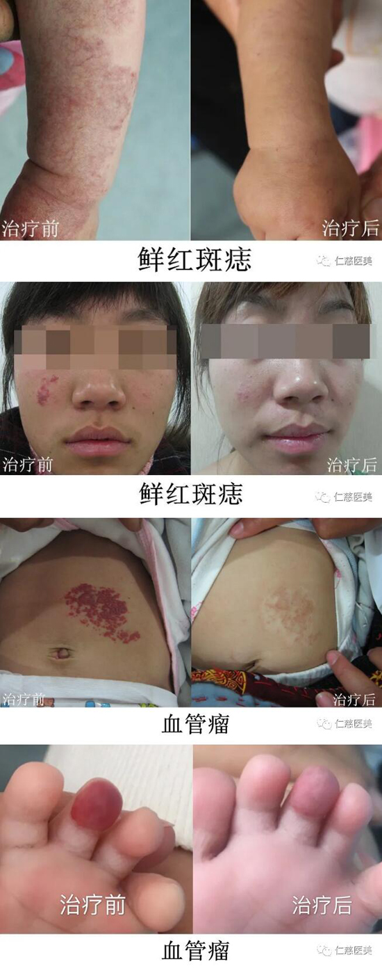 仁慈醫(yī)美