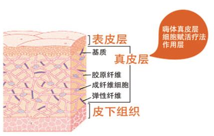 嗨體