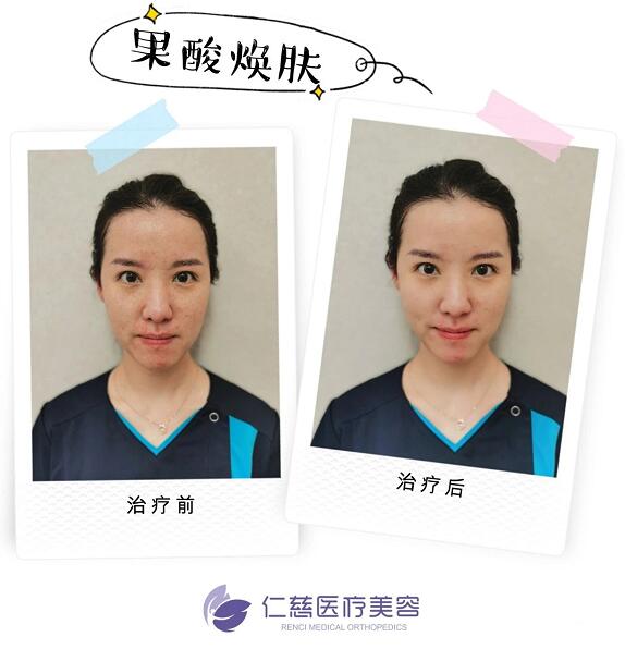 白條條