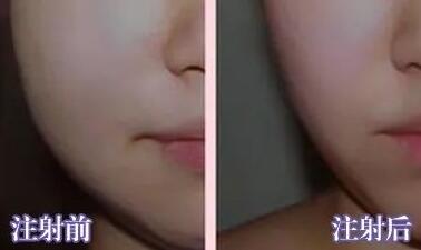 潘瑋柏妻子