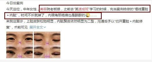 話癆景甜