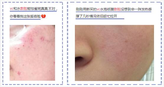 維C敷臉