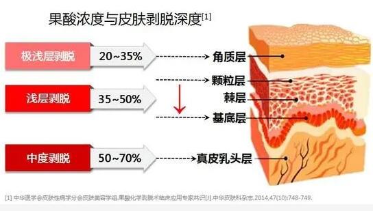 黑頭