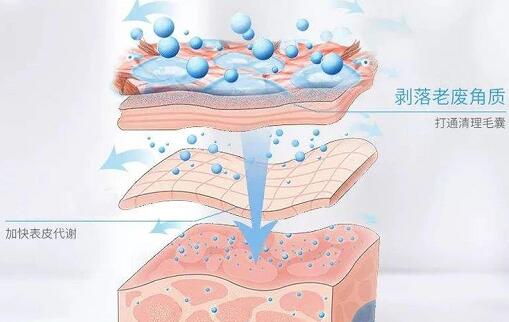 黑頭