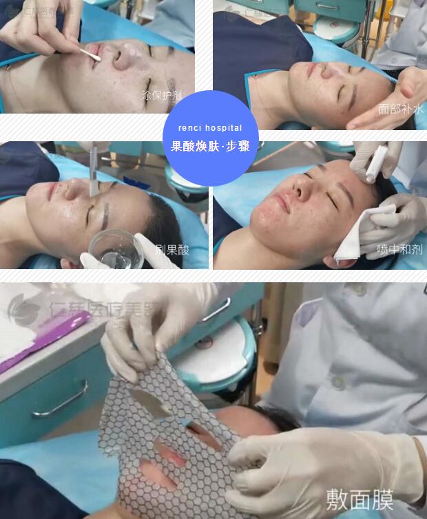 黑頭