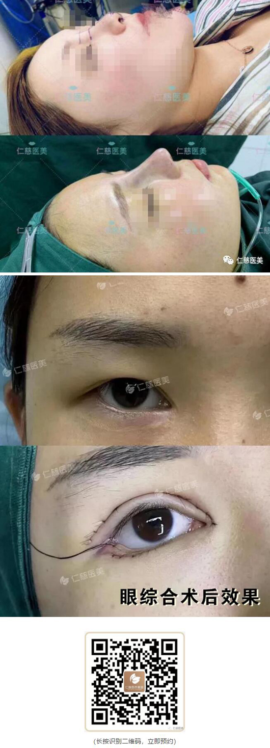 劉凱