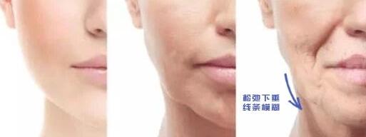 下頜線