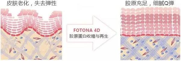 下頜線